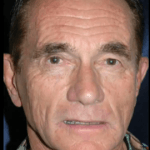 Hilos Tensores Clinicas Vicario