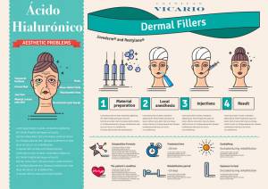 relleno dérmico de ácido hialuronico