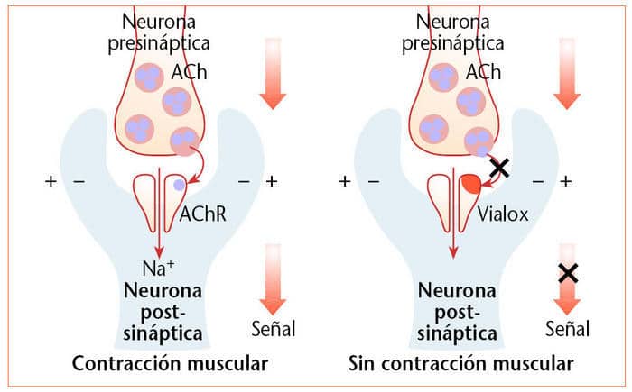 Lifting Muscular- intercambio eléctrico