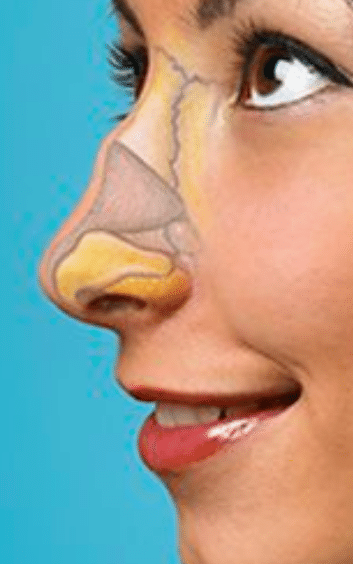 Rinomodelación cartilagos