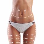 Mesoterapia Clinicas Vicario