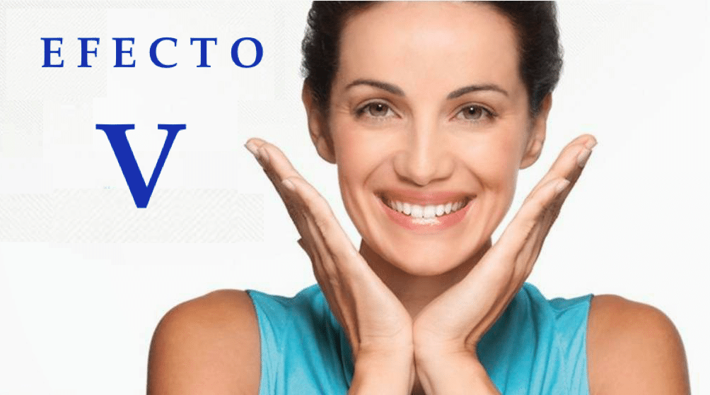 Radiesse efecto V Clinica Vicario