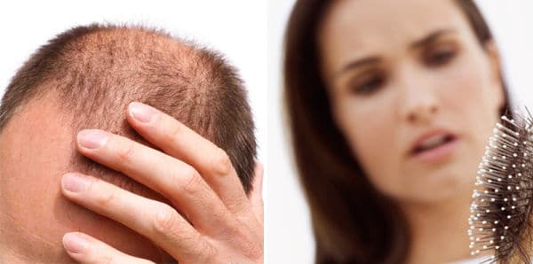 clinica vicario mesoterapia capilar
