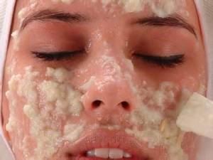 clinica vicario Peelings naturales