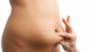 barriga y grasa abdominal CLinica Vicario