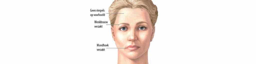 envejecimiento facial Clinica Vicario