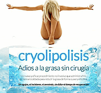 criolipolisis