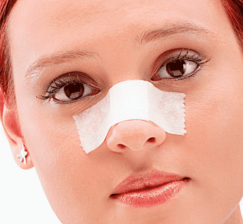 Rinoplastia sin cirugia