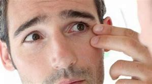 clinica vicario Arrugas de Expresión o en los ojos como Elimiarlas?