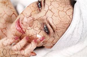 Cuidados Para las Pieles Secas Clinica Vicario Cuidados Para las Pieles Secas, y prevención de Arrugas